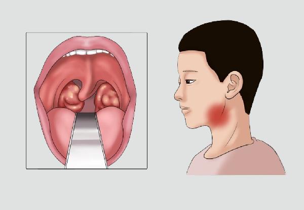 骑自行车有利于身心健康 至少给身体带来6大优点